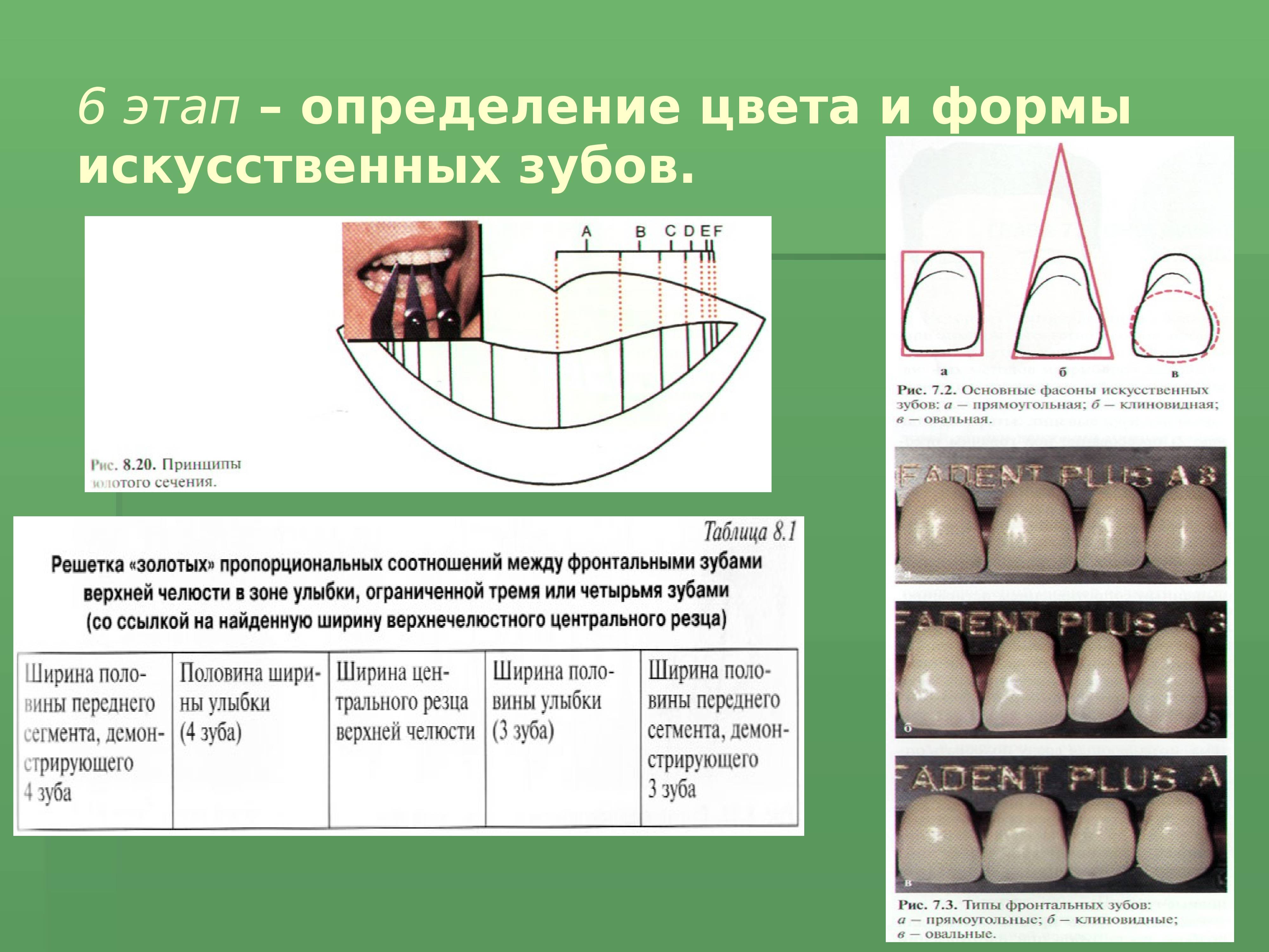 Изменение формы и окраски. Форма искусственных зубов. Искусственные зубы по форме. Формы фронтальных зубов. Определение цвета искусственных зубов.