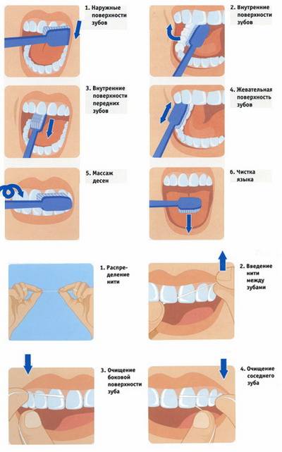 Как правильно чистить зубы: профилактика кариеса
