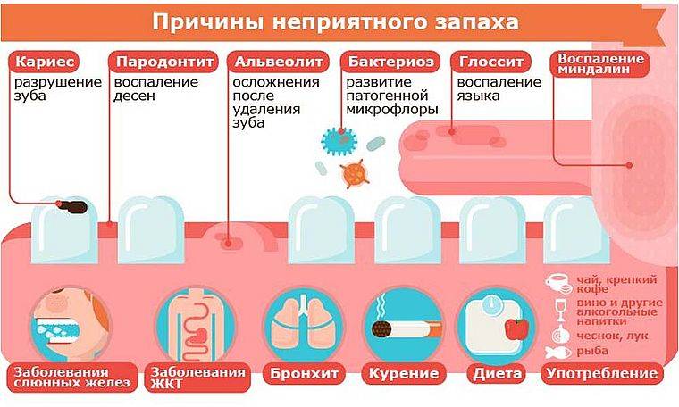 Выделения с запахом у женщин | университетская клиника