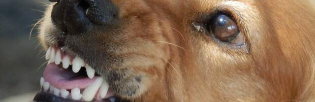 Что делать, если укусила собака: порядок действий, как возместить вред, куда обращаться