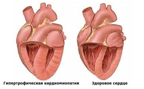 Болезни сердца у кошек - симптомы и признаки, лечение сердечных заболеваний у кошек в москве. ветеринарная клиника "зоостатус"