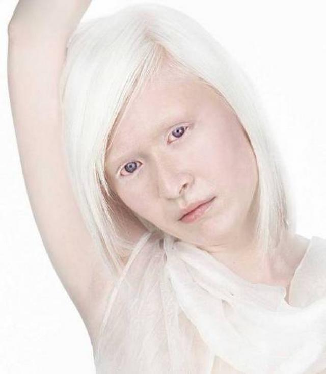 Красивые животные альбиносы фото подборка | science debate