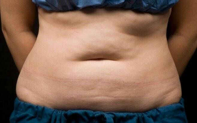 Что такое висцеральный жир и нужно ли от него избавляться