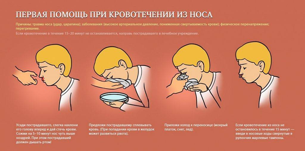 Воспаление носовых пазух, симптомы и лечение околоносовых придаточных пазух и слизистой оболочки