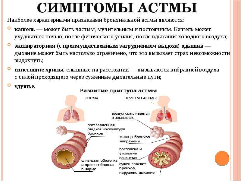 Бронхиальная астма - воспаление бронхов.: причины, жалобы, диагностика и методы лечения на сайте клиники «альфа-центр здоровья»