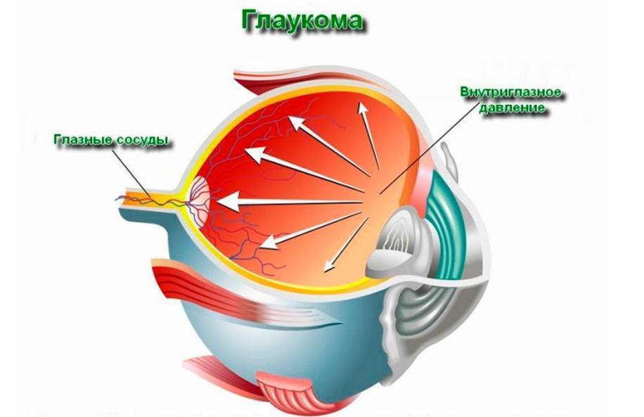 Глаза давление сильное. Измерить давление глазного дна. Аппарат для глазного давления. Глаукома низкого давления.