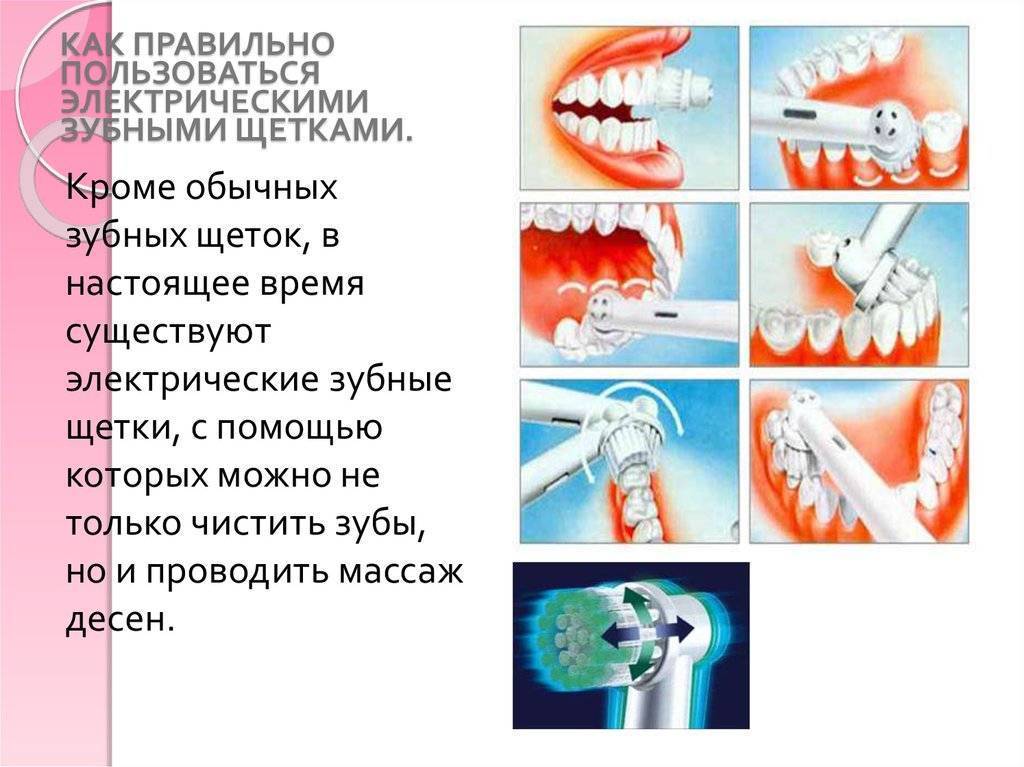 как пользоваться электрическими зубными щетками