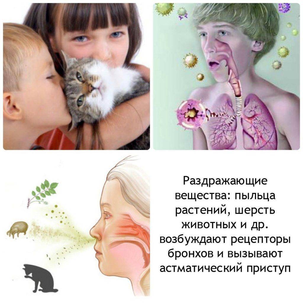 Как отличить аллергическую сыпь от инфекционной